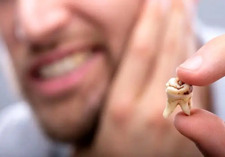 پنج اشتباه رایج در مراقبت از دندان‌ها