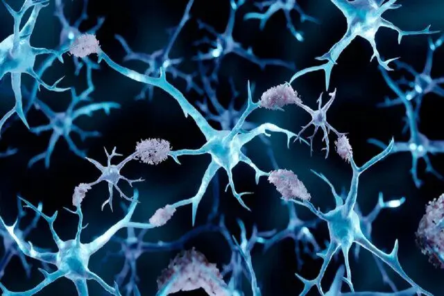 چرا مبتلایان به سرطان کمتر آلزایمر می‌گیرند؟