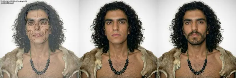 بازسازی چهره