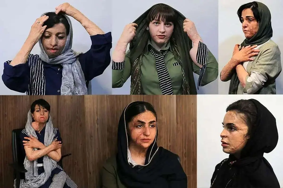 دختران سوخته شین‌آباد این روزها چه می‌کنند