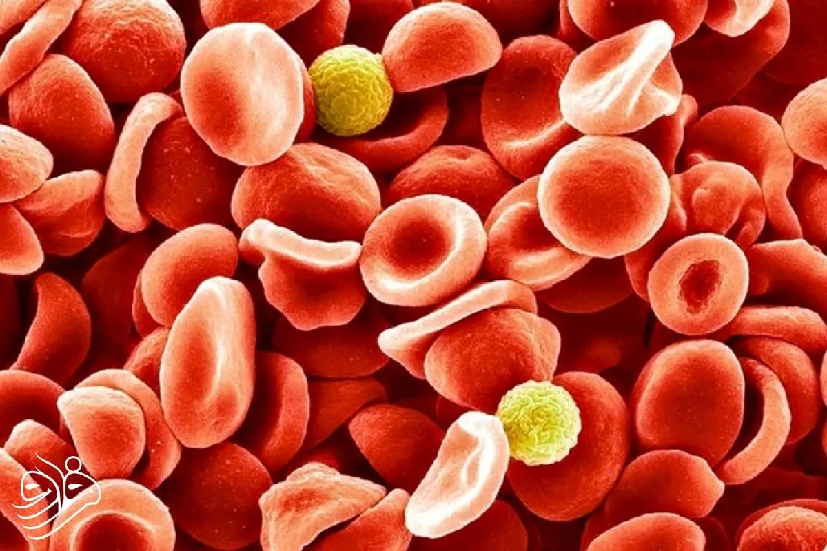 نادرترین گروه خونی جهان بالاخره شناسایی شد