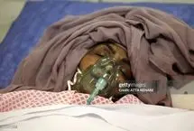 تصاویری از مجروحان حملات اسرائیل در بیمارستان رسول اکرم تهران 