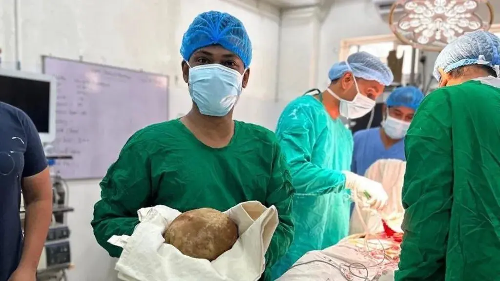 خارج کردن سنگ مثانه به وزن ۳.۱ کیلوگرم از بدن بیمار ۵۵ ساله
