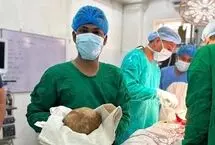 خارج کردن سنگ مثانه به وزن ۳.۱ کیلوگرم از بدن بیمار ۵۵ ساله