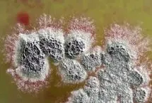  آنتی‌بیوتیک قدرتمندی که مقاوم‌ترین باکتری‌ها را نابود می‌کند