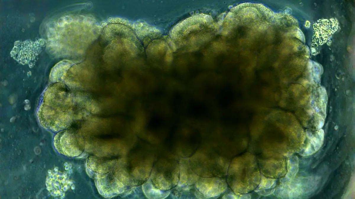 ساخت مینی‌مغزی که می‌تواند مسئله حل کند!