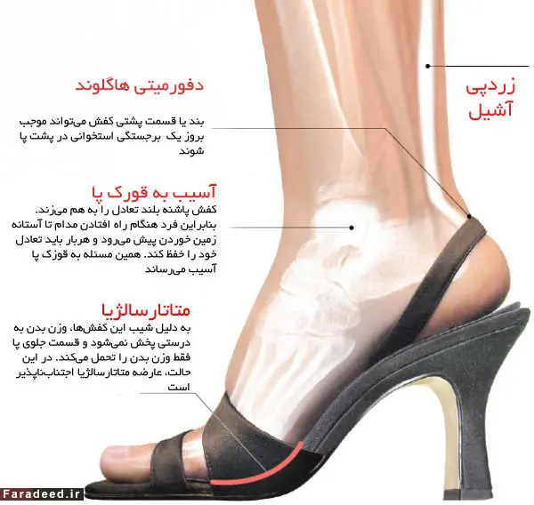 کفش پاشنه بلند؛ به چه قیمتی؟