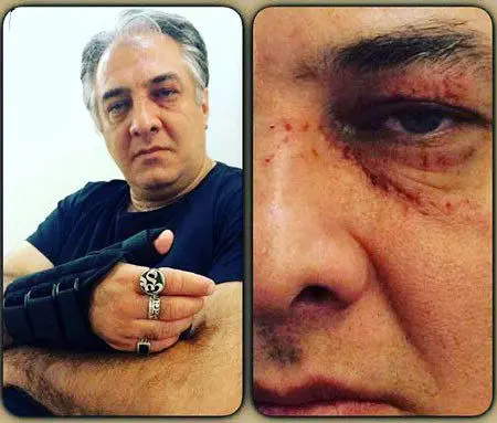 ایرج نوذری دچار سانحه شد (+عکس)