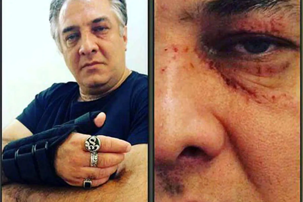 ایرج نوذری دچار سانحه شد (+عکس)