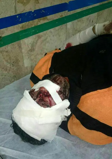 نجات چوپان از چنگال پلنگ در سوادکوه