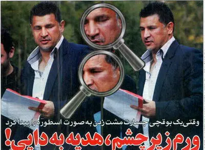 عکس> صورت مشت خورده علی دایی