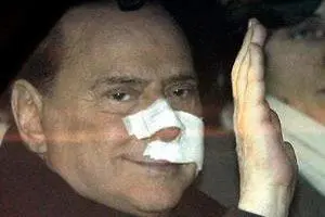 عکس>برلوسکنی باز هم زیر تیغ جراحی!