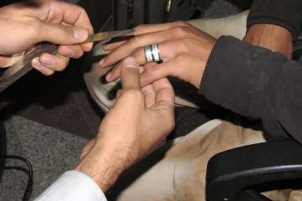 عکس> حلقه انگشتری که دردسر ساز شد
