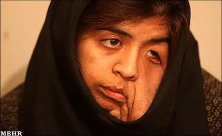 کمکهای مردمی برای دستیابی رویا به آرزوهایش