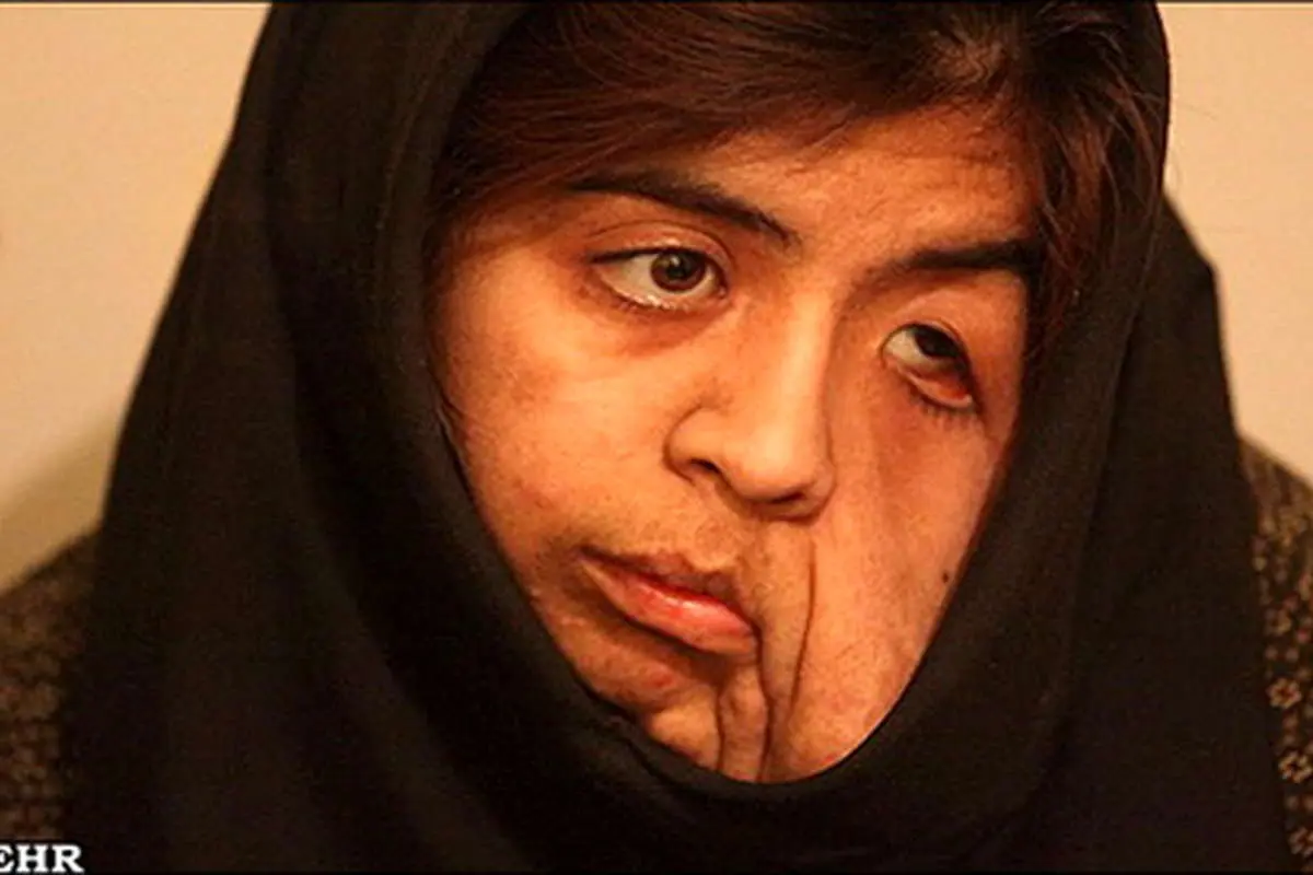 کمکهای مردمی برای دستیابی رویا به آرزوهایش