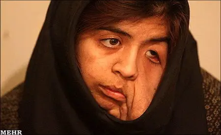 کمکهای مردمی برای دستیابی رویا به آرزوهایش