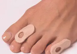 چند توصيه بهداشتي براي پيشگيري از زگيل