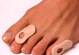 چند توصيه بهداشتي براي پيشگيري از زگيل
