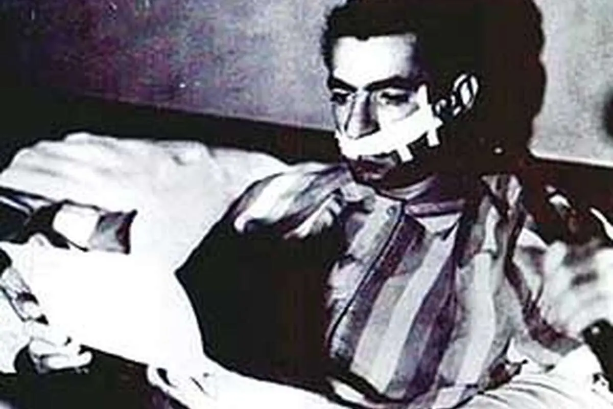 ماجرای عمل زیبایی محمدرضا شاه+ (تصویر)