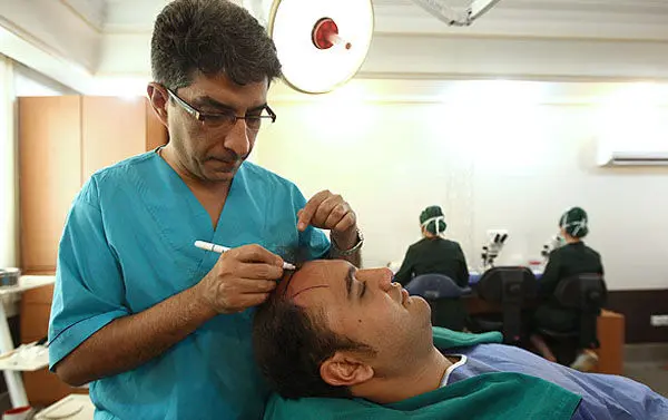 (تصاویر) عمل کاشت موی طبیعی