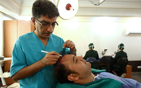 (تصاویر) عمل کاشت موی طبیعی