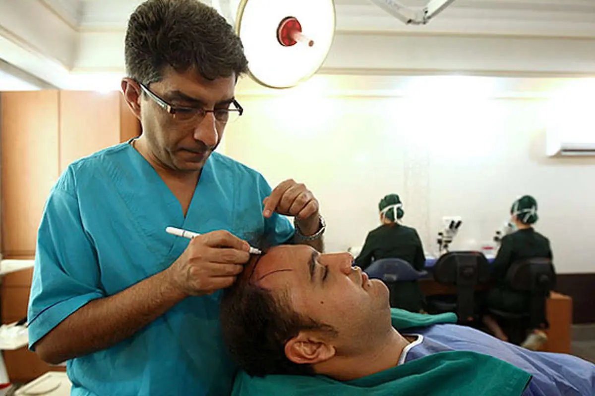 (تصاویر) عمل کاشت موی طبیعی