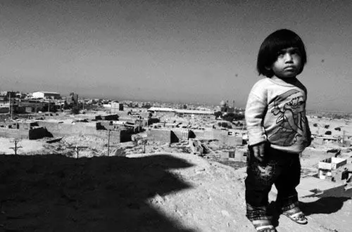 (تصاویر) مصائب معلولیت یک دختر 10ساله