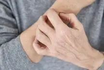 استرس جنگ و افزایش خشکی و التهاب پوست/ توصیه های طب ایرانی برای محافظت از پوست