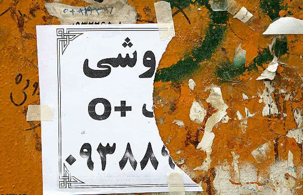 (تصاویر) تبلیغات خرید و فروش کلیه