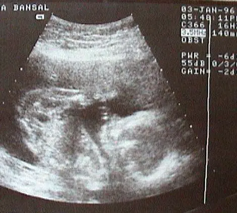 (تصاویر) دختری که از هر روز زندگی‌‌اش یک عکس دارد!