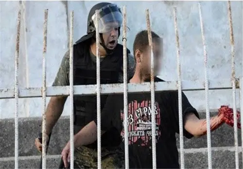 (تصاویر) قطع دست هودار با نارنجک پلیس!
