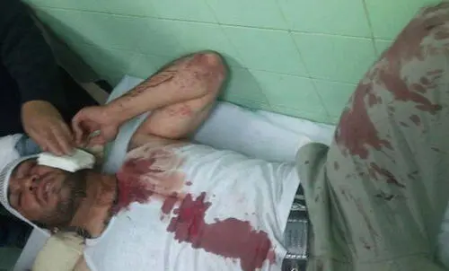 (تصویر) شلیک به صورت یک محیط‌بان