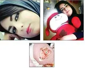 اسیدپاشی بر صورت دختر مورد علاقه همسر!