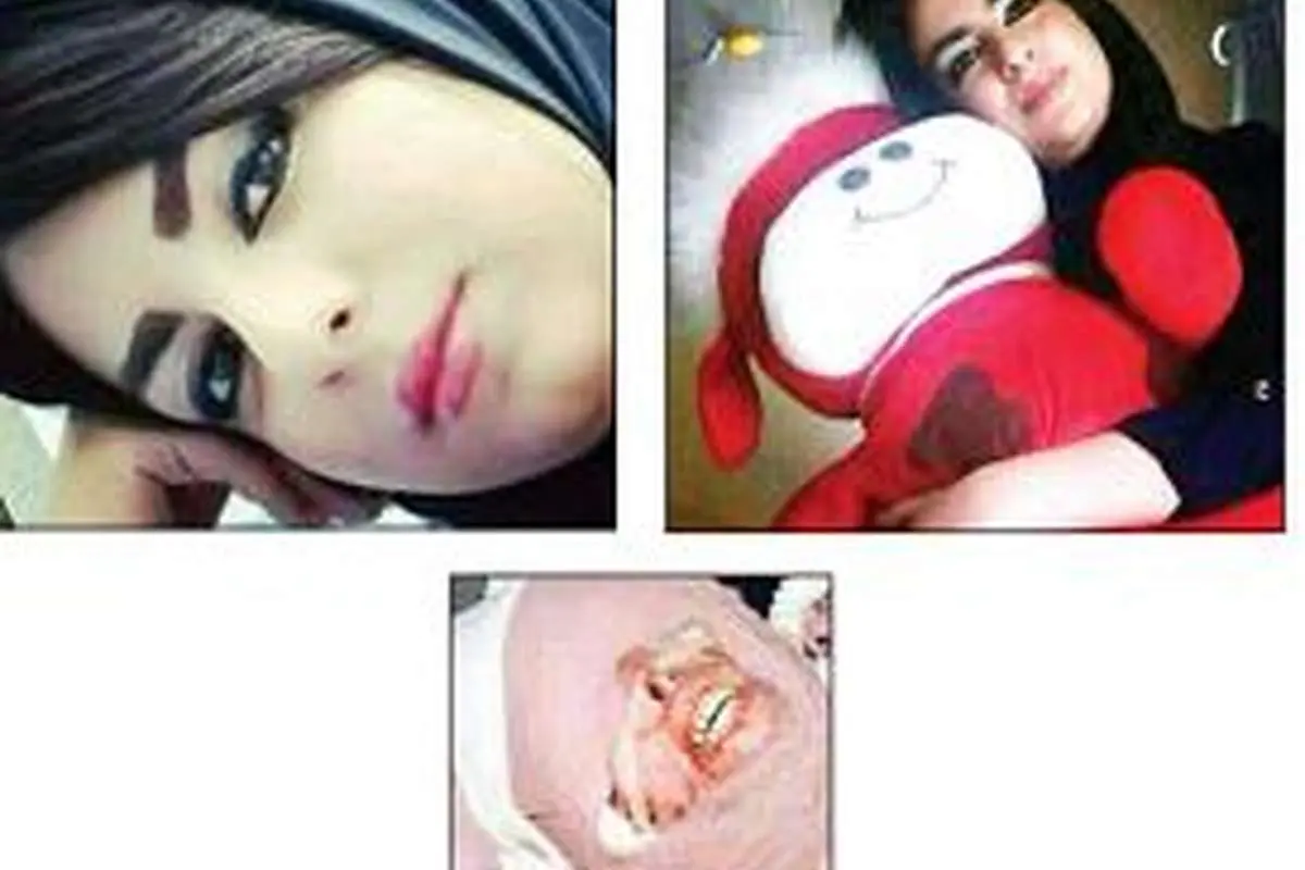 اسیدپاشی بر صورت دختر مورد علاقه همسر!