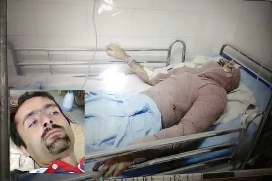 اسیدپاشی ​دو زن بر روی مرد جوان در هشترود
