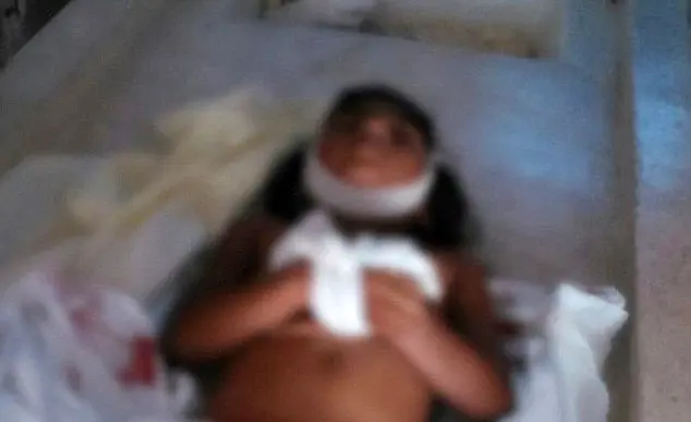 خورده شدن دختر شش‌ساله توسط ماهی‌های گوشت‌خوار