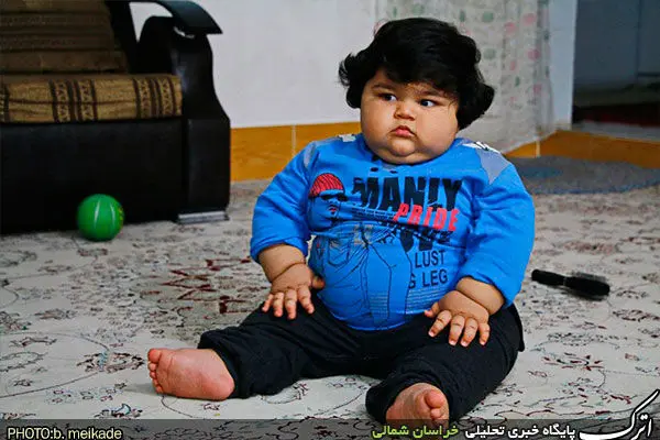 (تصاویر) کودک یک ساله بجنوردی با ۴۲ کیلو وزن