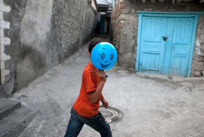 (تصاویر) زندگی پسر بچه بدون چهره