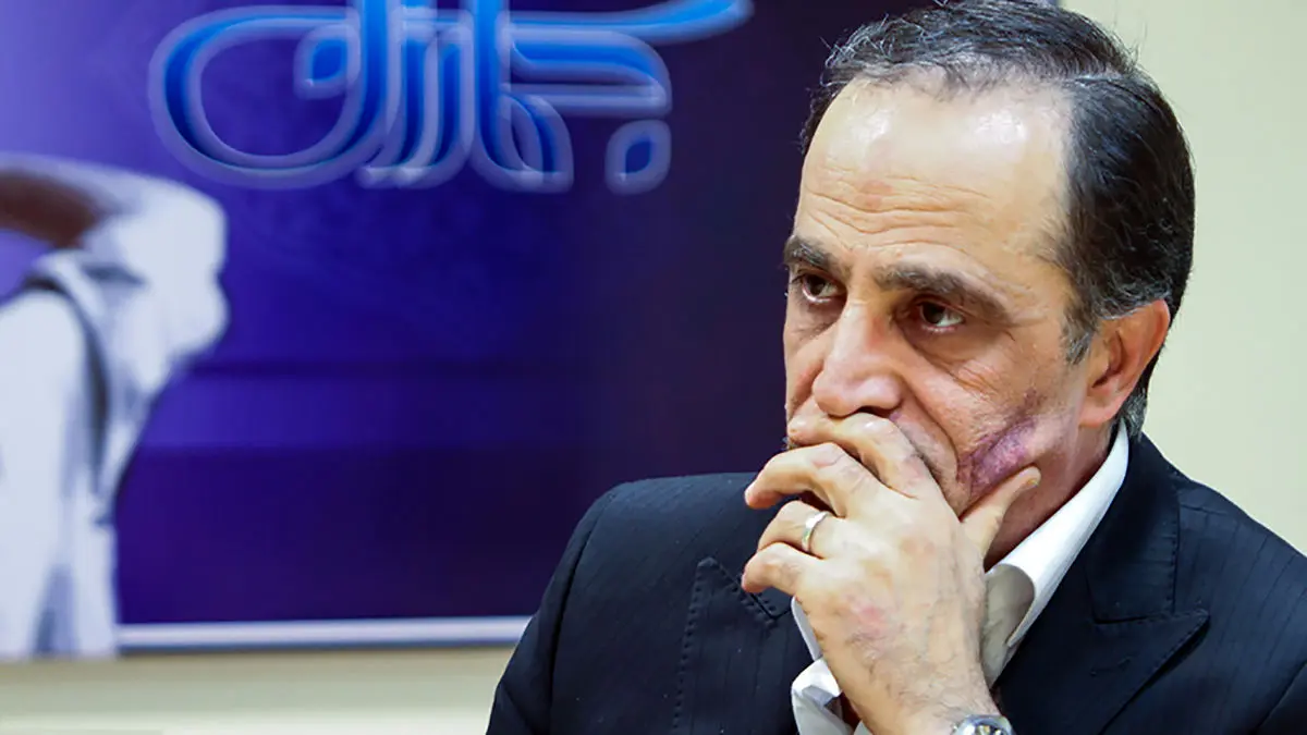 شهرداری تهران و ۴ امکان