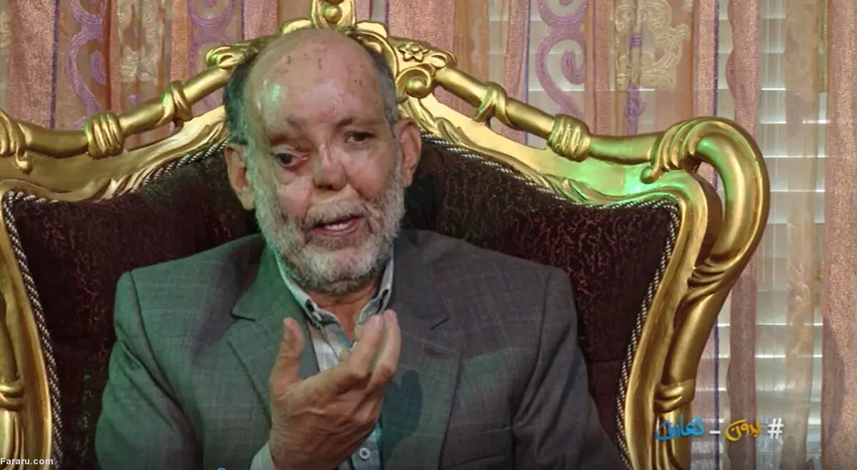 (ویدئو) جانبازی که ۶۵ بار زیر تیغ جراحی رفت