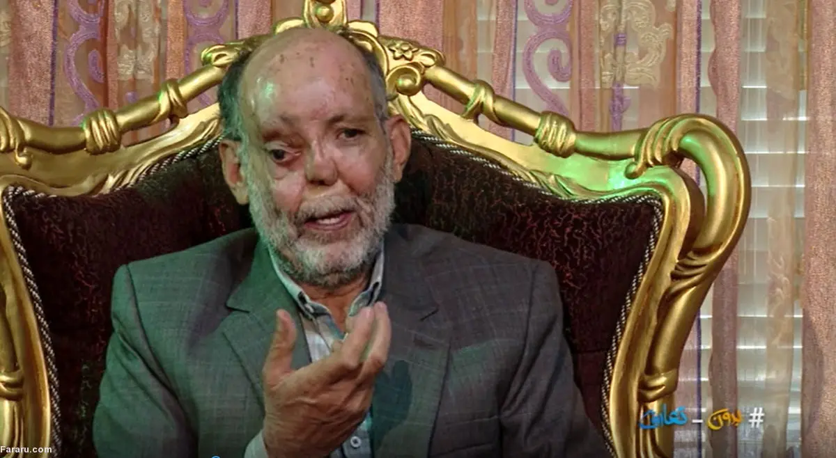 (ویدئو) جانبازی که ۶۵ بار زیر تیغ جراحی رفت