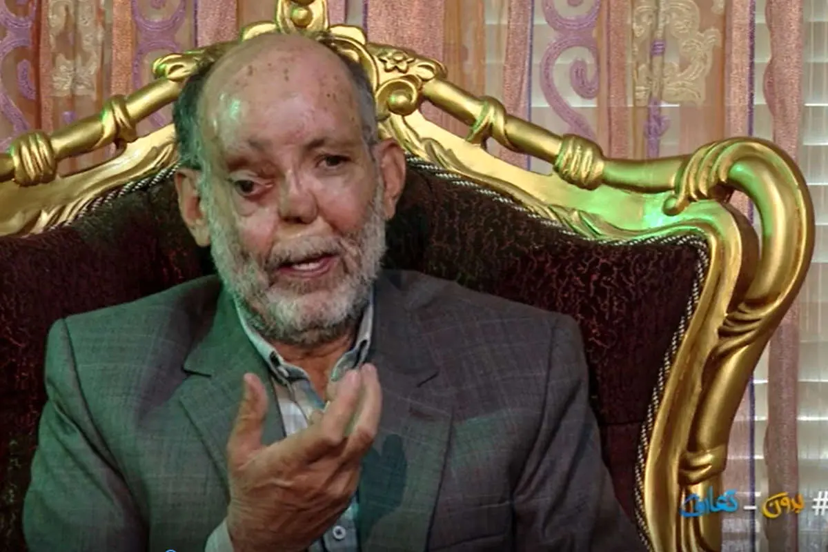 (ویدئو) جانبازی که ۶۵ بار زیر تیغ جراحی رفت