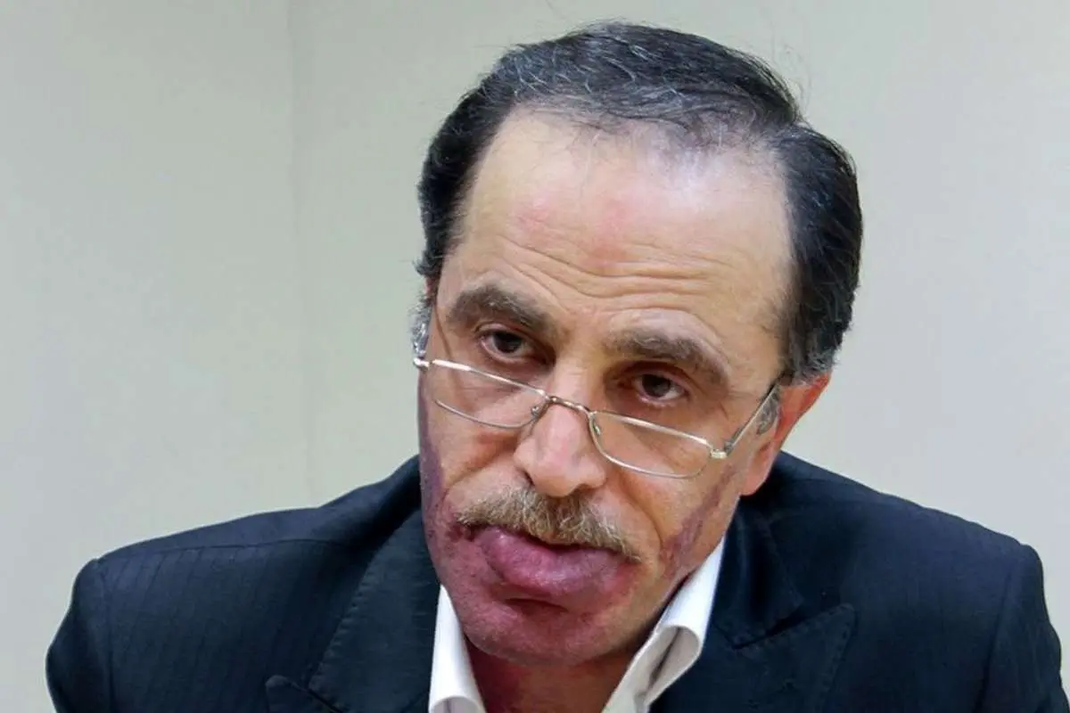 بررسی طرح صیانت باید علنی باشد