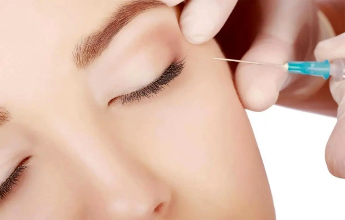 همه چیز درباره تزریق ژل و بوتاکس