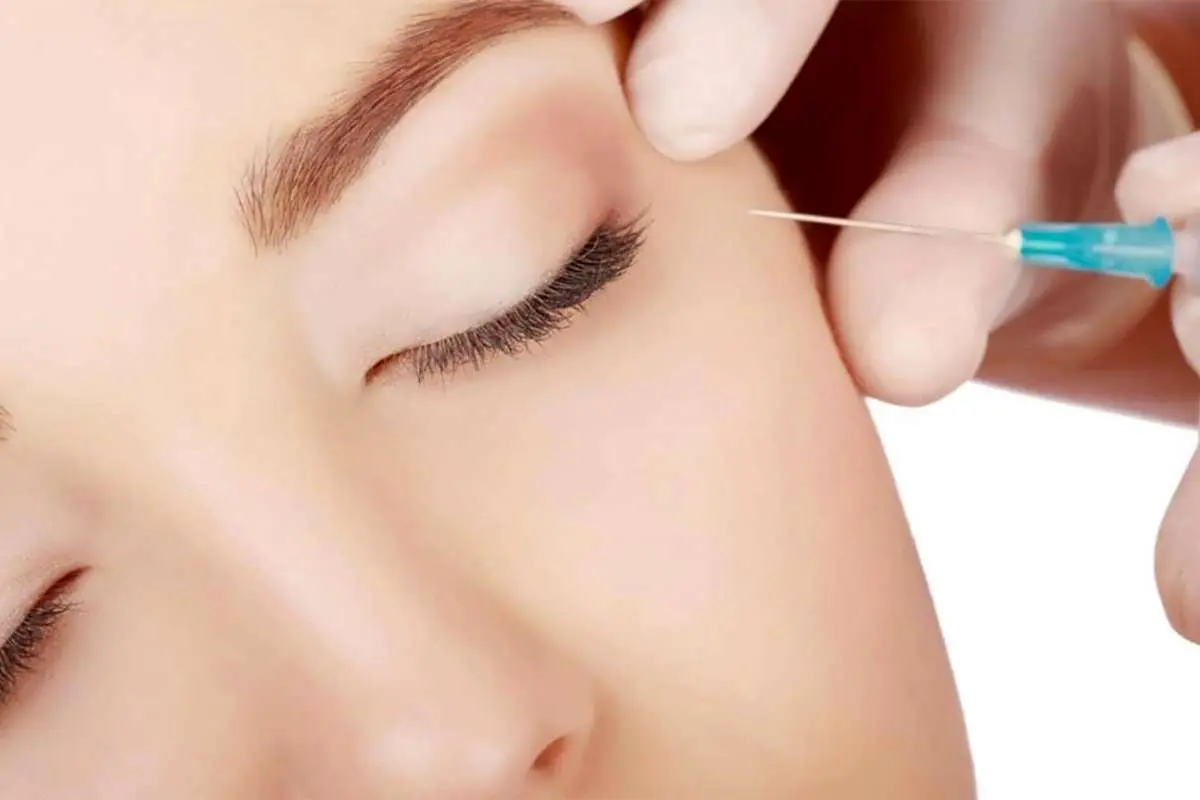 همه چیز درباره تزریق ژل و بوتاکس