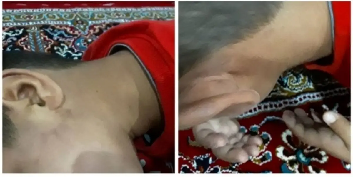 شکنجه دانش آموز کلاس اول توسط معلم