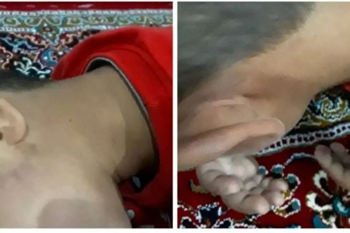 شکنجه دانش آموز کلاس اول توسط معلم