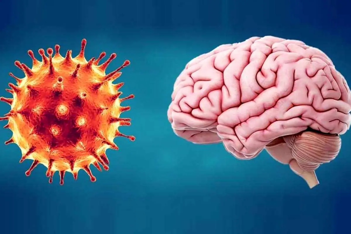 عارضه مه مغزی کرونا چیست؟