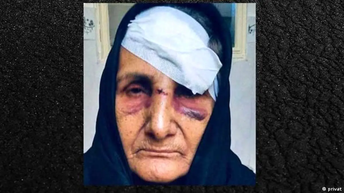 واکنش‌ها به مضروب‌شدن گوهر عشقی
