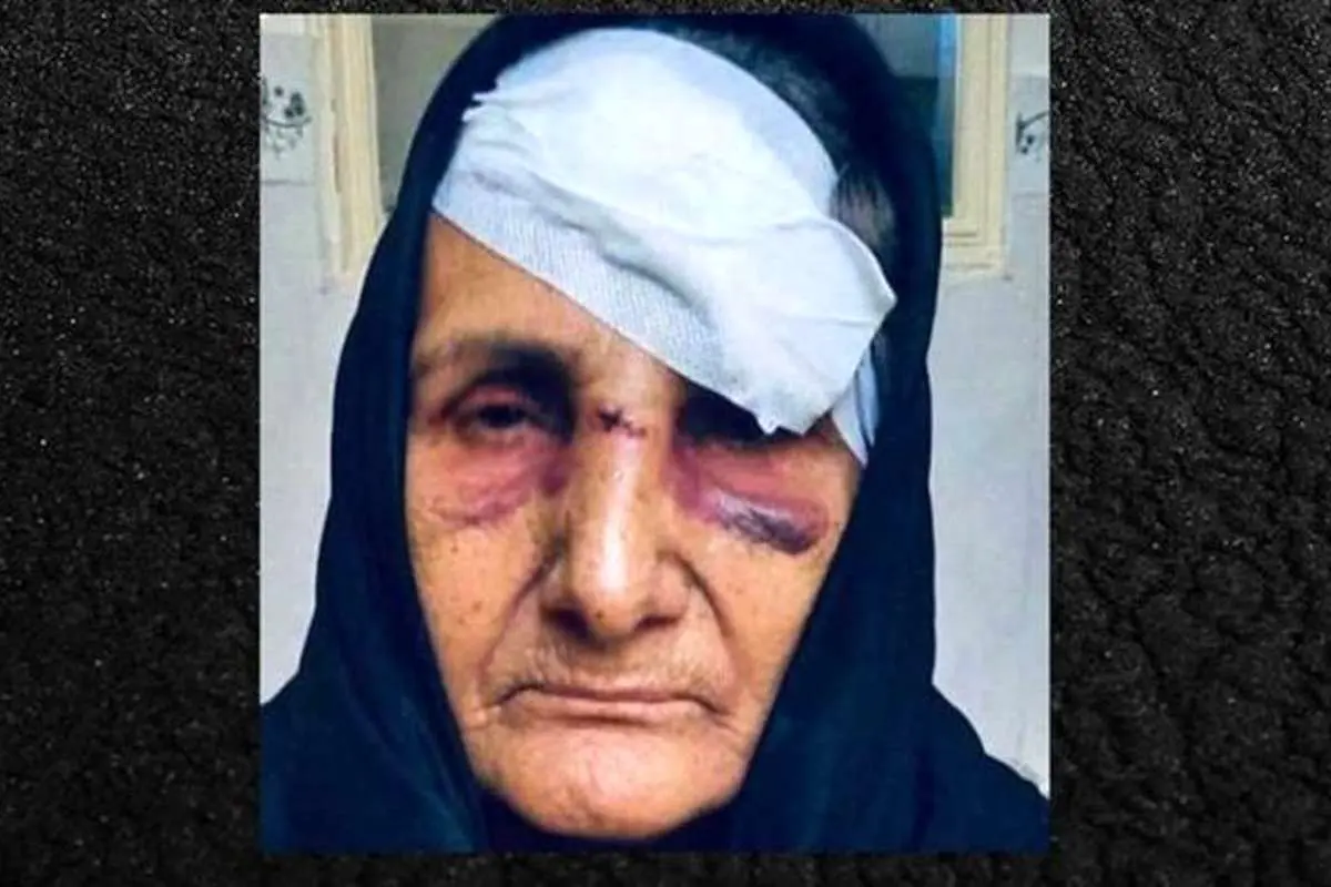 واکنشها به مضروبشدن گوهر عشقی